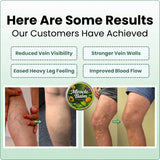 Miracle Balm Summer – Botanical Leg Comfort & Varicose Vein Care Balm