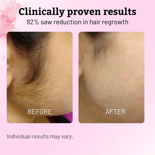 Natural Permanent Hair Remover Oil